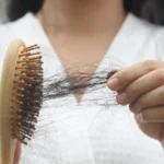 Wypadanie włosów po operacji bariatrycznej – dlaczego się pojawia i co możesz zrobić?